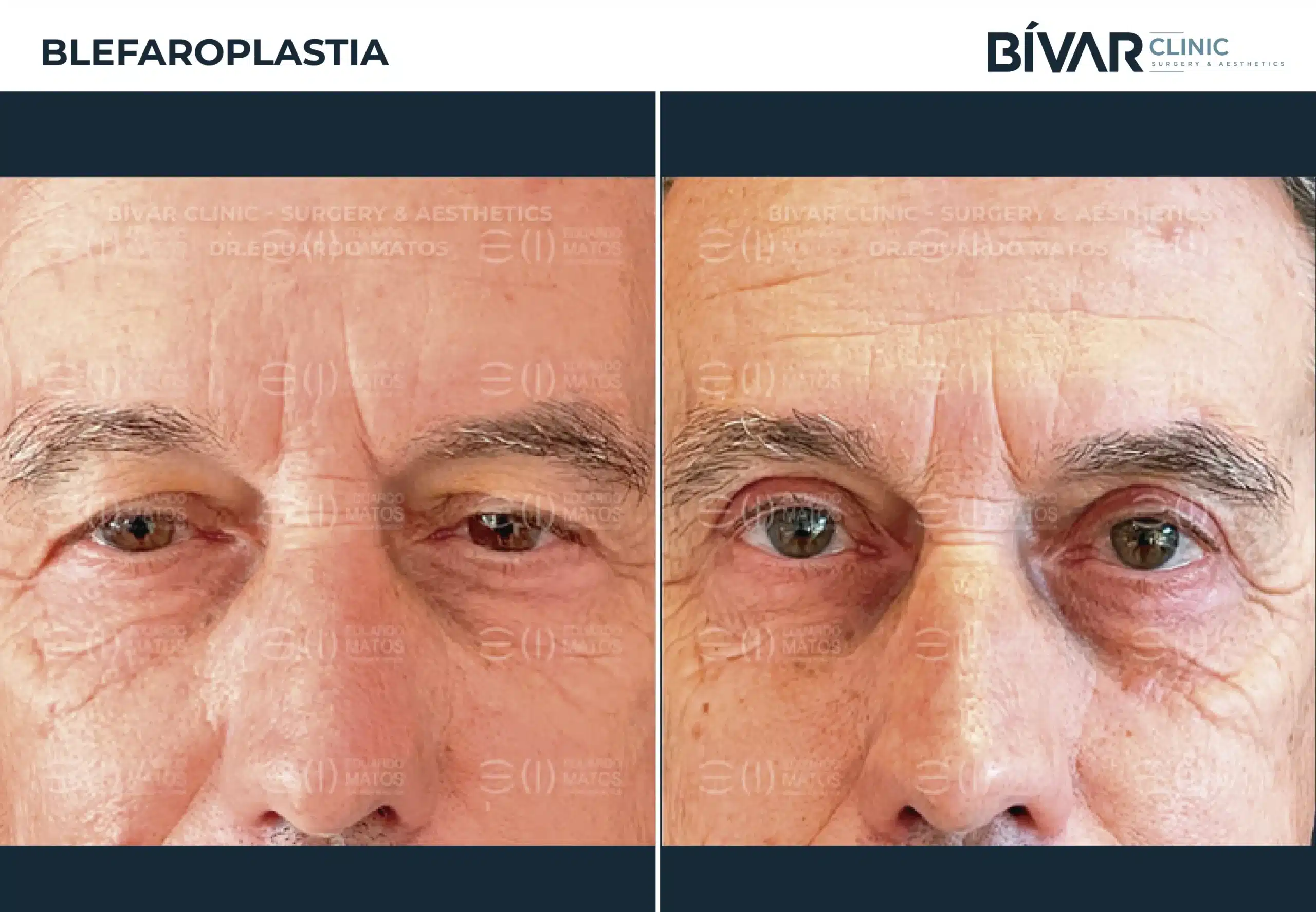 TEMPLATE-FINAL-1-4-scaled