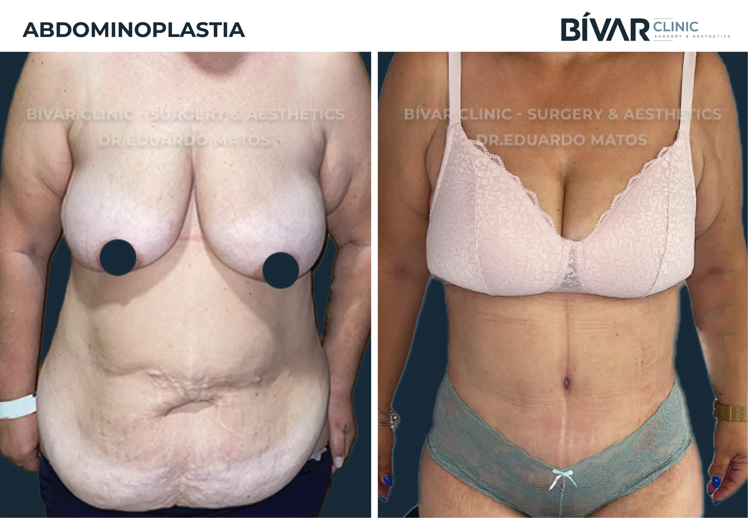 TEMPLATE-FINAL-1-scaled (1)